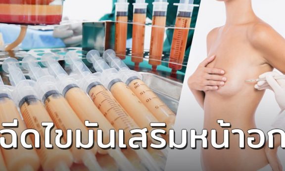 ฉีดไขมันเสริมหน้าอก