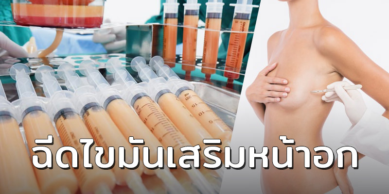 ฉีดไขมันเสริมหน้าอก